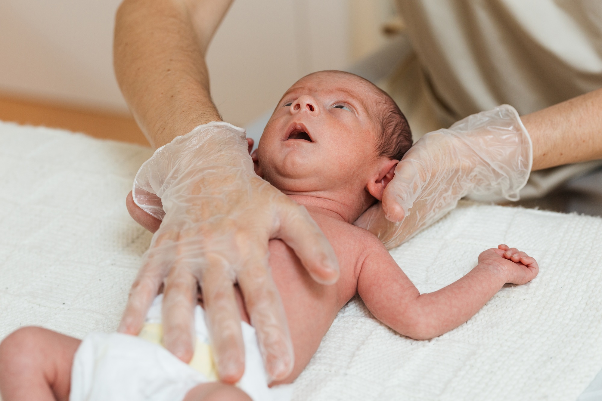 fisioterapia pediatrica Un bebé recién nacido yace sobre una manta blanca, mirando hacia arriba. Alguien coloca suavemente sus manos enguantadas sobre el abdomen del bebé. La escena transmite una atmósfera de cuidado y protección en un entorno médico. Daganzo Adyre